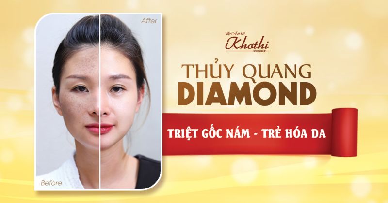 Căng bóng da thủy quang diamond