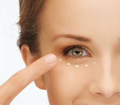 Lấy mỡ bọng mắt